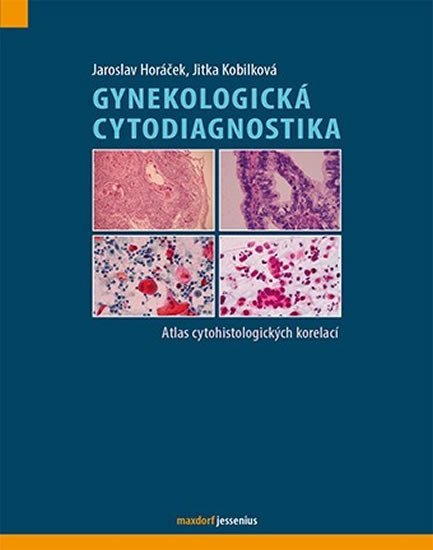 Levně Gynekologická cytodiagnostika - Atlas cytohistologických korelací - Jaroslav Horáček; Jitka Kobilková