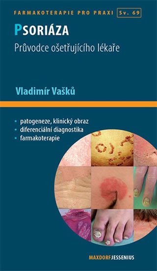 Levně Psoriáza - Průvodce ošetřujícího lékaře, 1. vydání - Vladimír Vašků