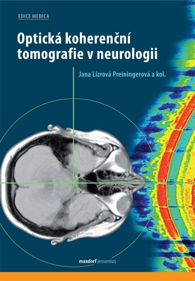 Levně Optická koherenční tomografie v neurologii - Jana Lízrová Preiningerová