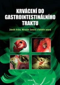 Levně Krvácení do gastrointestinálního traktu - Krška Zdeněk
