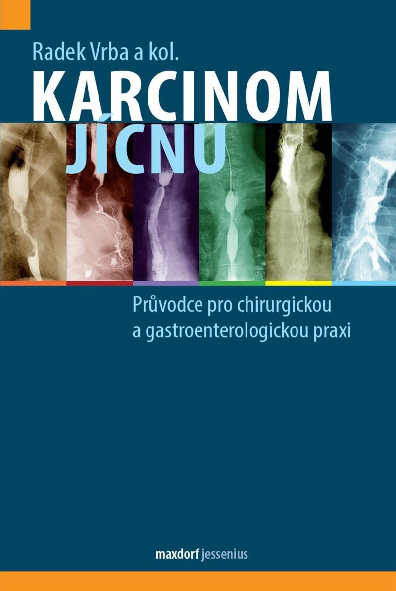 Levně Karcinom jícnu - Průvodce pro chirurgickou a gastroenterologickou praxi - Radek Vrba