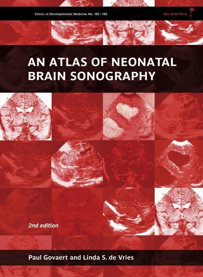 Levně An Atlas of Neonatal Brain Sonography - Paul Govaert