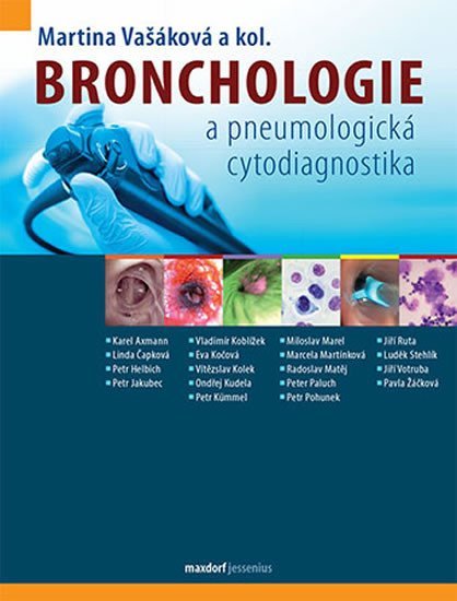 Levně Bronchologie a pneumologická cytodiagnostika - Martina Vašáková