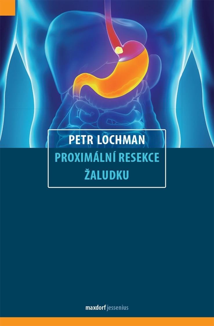 Levně Proximální resekce žaludku - Petr Lochman