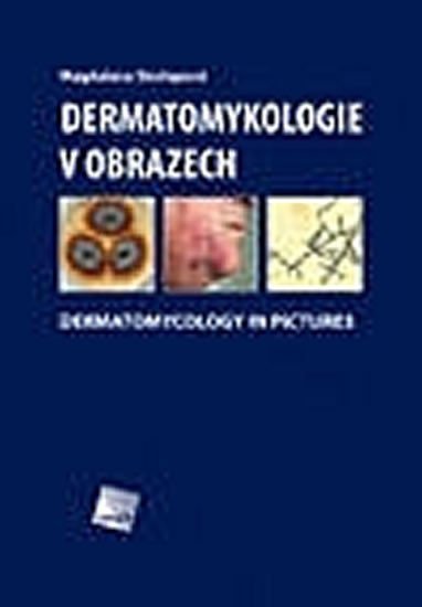 Levně Dermatomykologie v obrazech - Dermatomycology in Pictures - Magdalena Skořepová