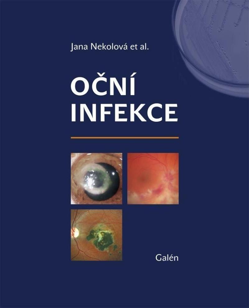 Levně Oční infekce - Jana Nekolová