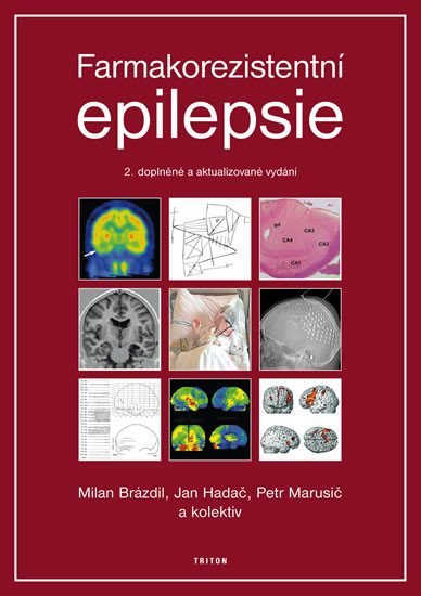 Farmakorezistentni epilepsie - 2. vydání - Milan Brázdil