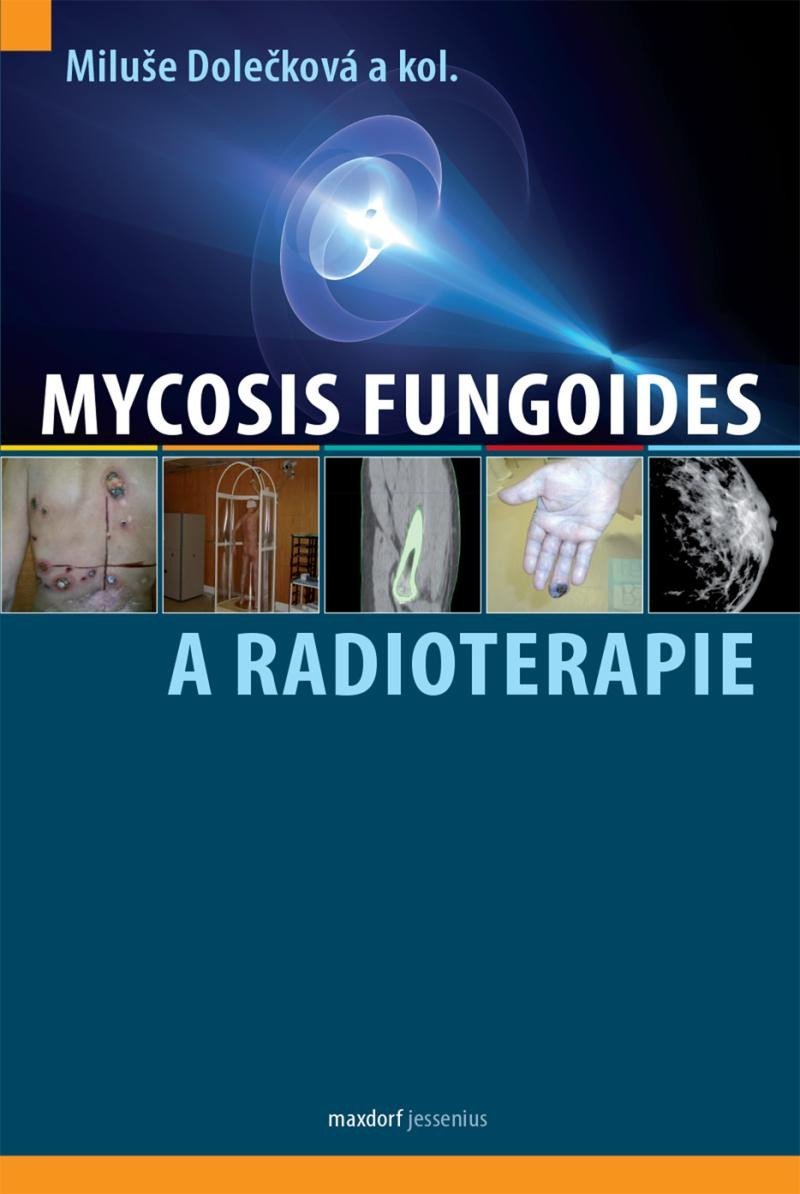 Levně Mycosis fungoides a radioterapie - kolektiv autorů