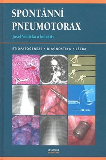 Levně Spontánní pneumotorax - Josef Vodička