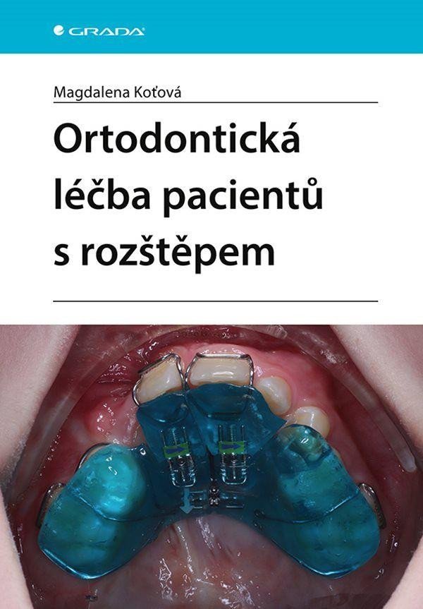 Levně Ortodontická léčba pacientů s rozštěpem - Magdalena Koťová