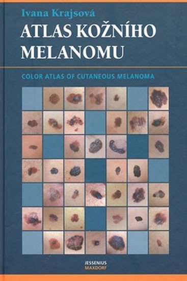 Levně Atlas kožního melanomu - Ivana Krajsová