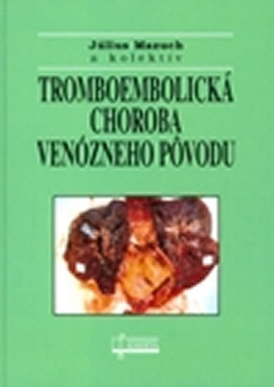 Levně Tromboembolická choroba venózneho pôvodu - Július Mazuch